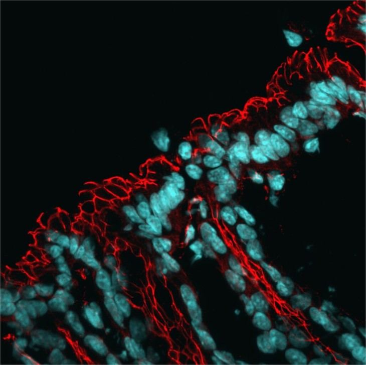Identifican un mecanismo que afecta la microbiota intestinal y eleva el riesgo de enfermedades