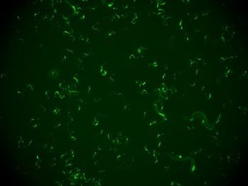 Gusanos muestran un mecanismo de memoria inmunitaria contra virus para prevenir reinfecciones