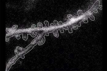 Neurones organizan señales para procesar la visión, revela estudio